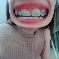 世界最帅小钢牙排名前十世界最帅小钢牙排名前十是谁