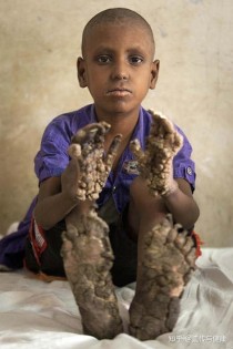 世界上最罕见人,世界上十大最高的人