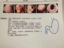 沈阳胃镜十大排名沈阳市胃镜哪家好一点